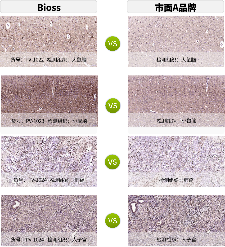新品上市 | 比传统HRP效果强数十倍?揭秘聚合物信号放大技术的颠覆性优势