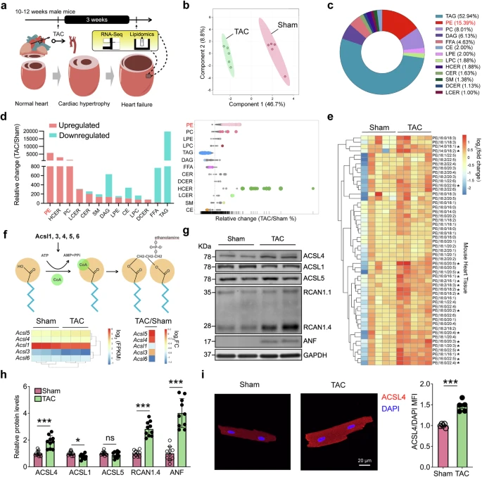 顶刊思维 | STTT重磅！铁死亡携手多组学，揭示心衰治疗新靶点