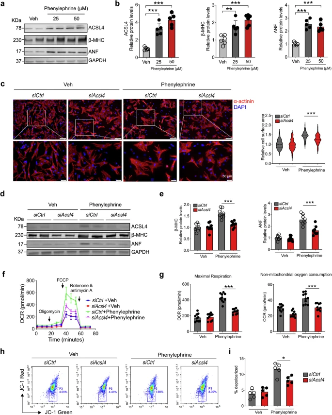 顶刊思维 | STTT重磅！铁死亡携手多组学，揭示心衰治疗新靶点