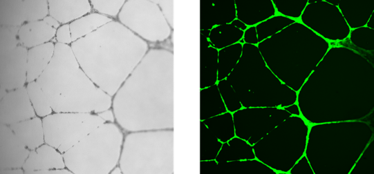 类器官爆火背后的“幕后hero”——基质胶