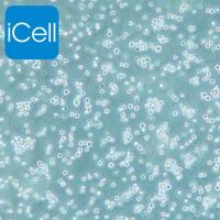 H22细胞 | H22细胞 | H-22细胞 | H-22 | 小鼠肝癌细胞/种属鉴定/镜像绮点(Cellverse)