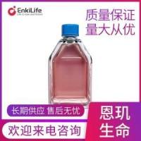 人支气管上皮细胞HBE135-E6E7(STR鉴定)