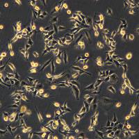 浙江美森-人肺腺癌细胞 NCIH1975