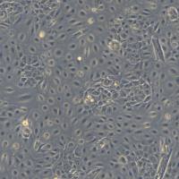 人原代子宫颈上皮细胞 CTCC-209-HUM