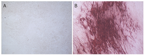 茜素红S染色液(0.2%, pH8.3)