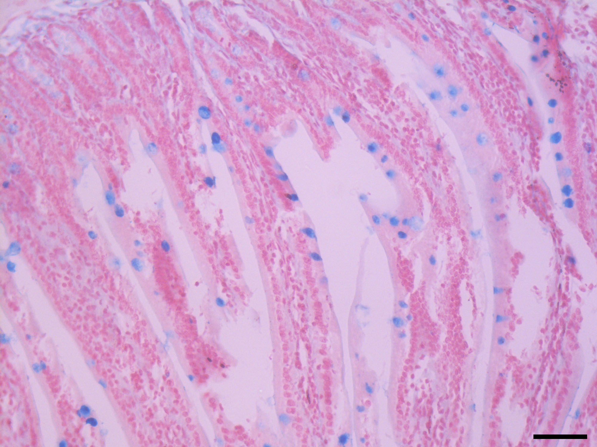 阿尔新蓝-核固红染色试剂盒(pH1.0)