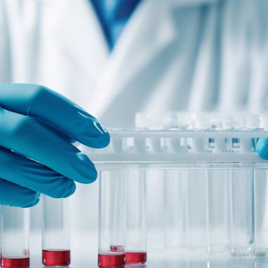 布鲁SHI氏杆菌抗体检测卡（金标POCT）