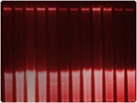 Southern Blot印迹杂交分步指南-赛默飞