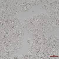 人胚胎干细胞hESC(H1)