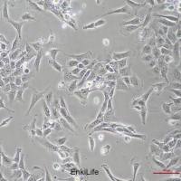 人心肌细胞AC16(STR鉴定)