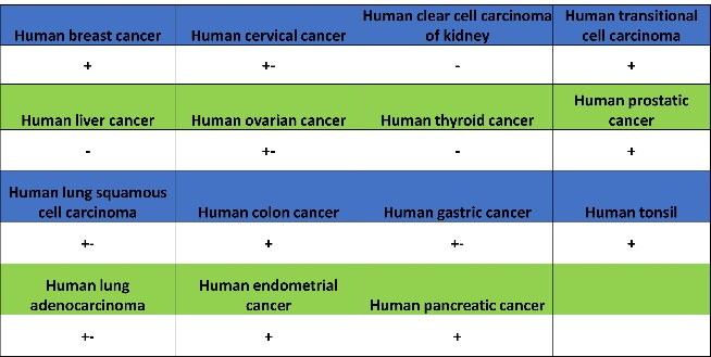 肿瘤病理靶点：MLH1和NaPi2b/SLC34A2解析