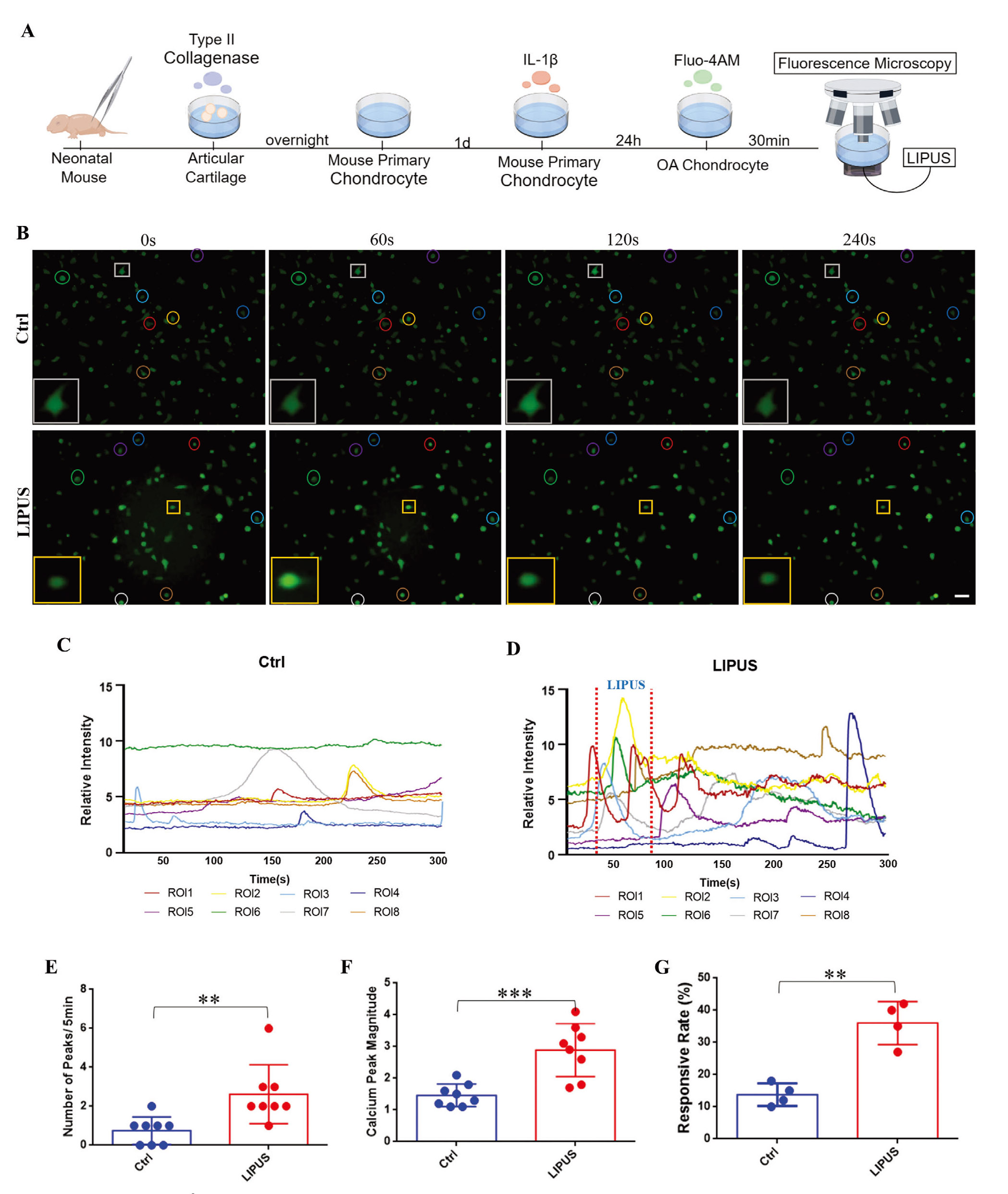 Adv Sci丨重庆医科大学研究团队揭示低强度脉冲超声治疗延缓骨关节炎进展的机制