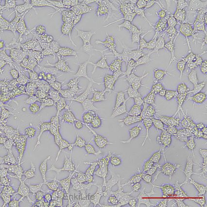 人鼻咽癌细胞C666-1(STR鉴定)