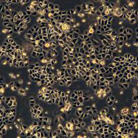 人胃腺癌细胞 AGS