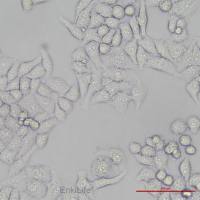 人胃粘膜上皮细胞GES-1(STR鉴定)