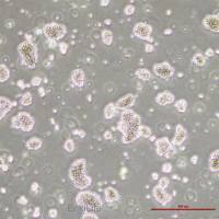人急性淋巴母细胞白血病细胞MT-4(STR鉴定)