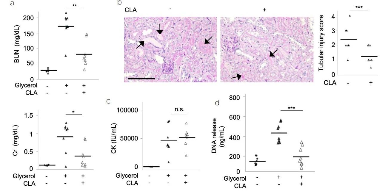 《Nature Medicine》重磅突破:巨噬细胞外陷阱与血小板激活驱动肌溶解肾损伤,揭示治疗新靶点