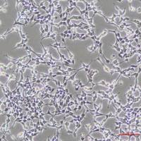 人神经母细胞瘤细胞IMR-32(STR鉴定)