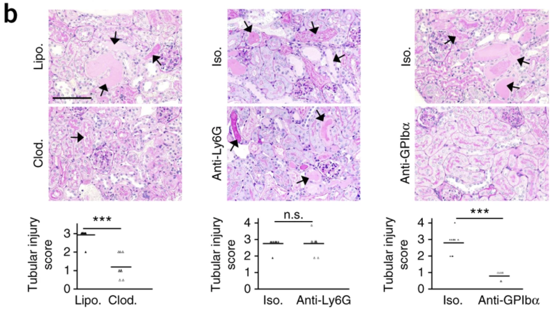 《Nature Medicine》重磅突破:巨噬细胞外陷阱与血小板激活驱动肌溶解肾损伤,揭示治疗新靶点