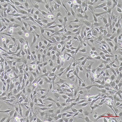 永生化人脑微血管内皮细胞hCMEC/D3(STR鉴定)