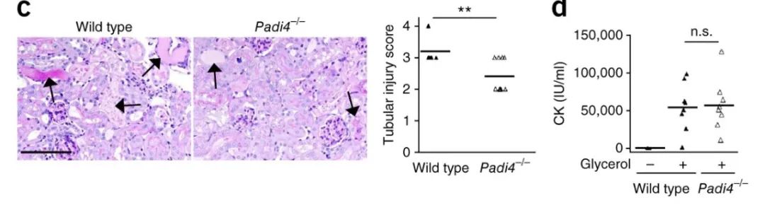 《Nature Medicine》重磅突破:巨噬细胞外陷阱与血小板激活驱动肌溶解肾损伤,揭示治疗新靶点