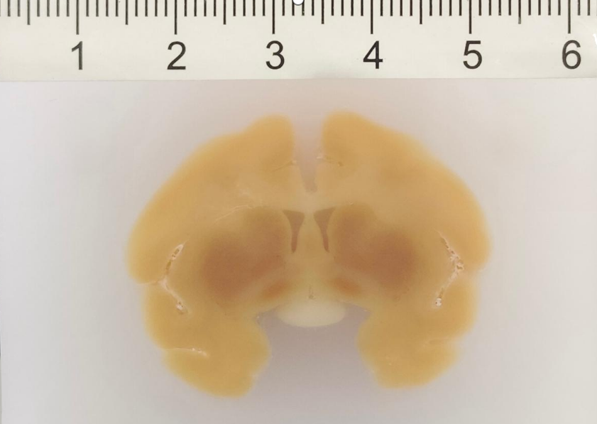 龙迈达斯食蟹猴整脑组织连续切片