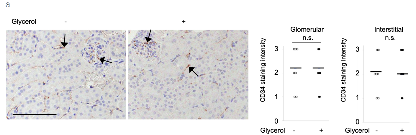 《Nature Medicine》重磅突破:巨噬细胞外陷阱与血小板激活驱动肌溶解肾损伤,揭示治疗新靶点