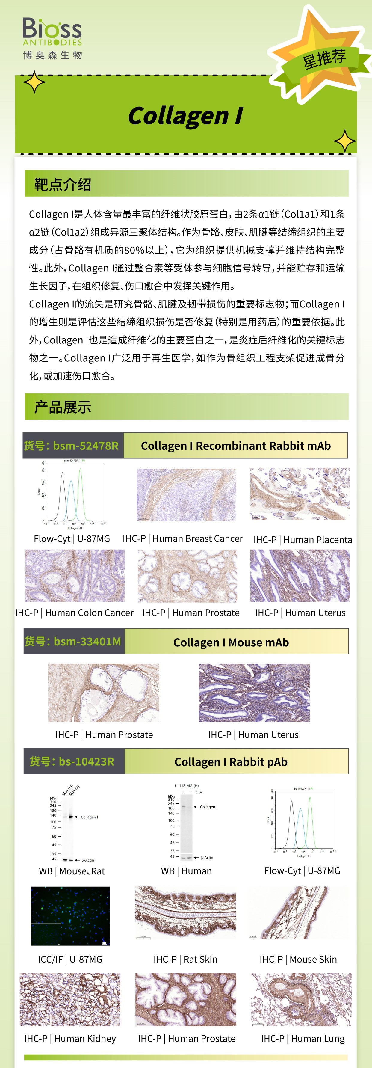 Bioss 星推荐 | Collagen I 抗体