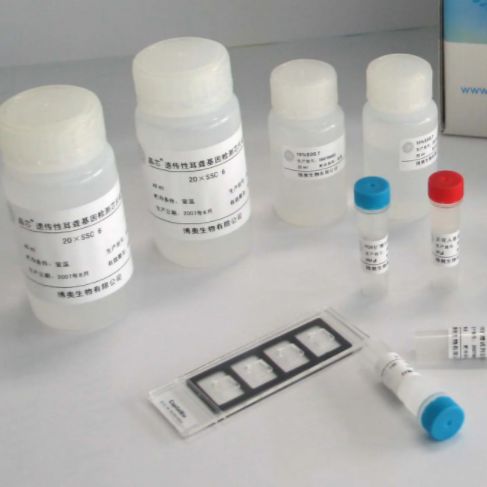 微生物草酰乙酸转羧酶(OTC)ELISA试剂盒