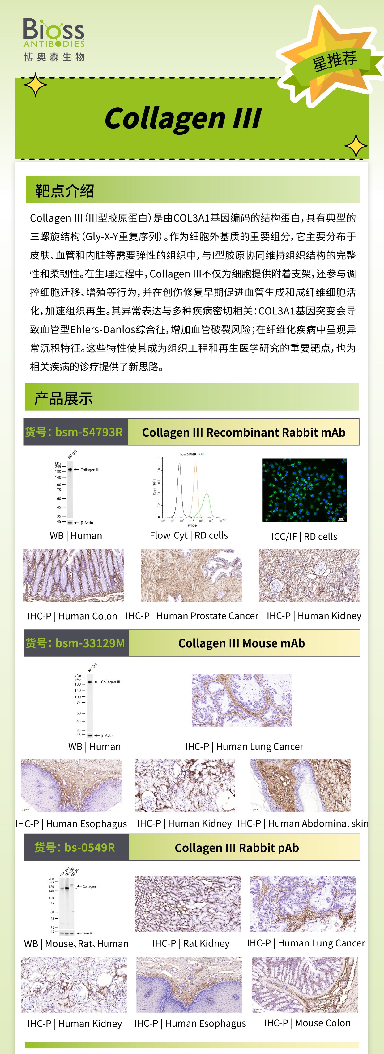 Bioss 星推荐 | Collagen III 抗体