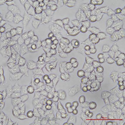 人卵巢癌细胞A2780(STR鉴定)