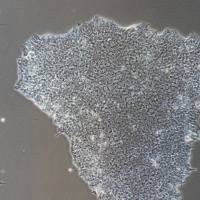 人胚胎干细胞H9(STR鉴定正确)