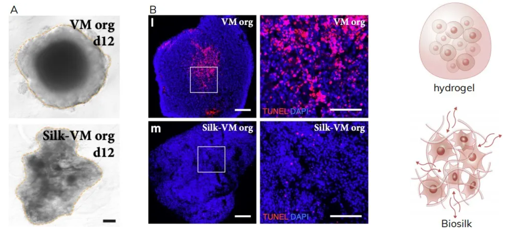 在Biosilk中及传统培养VM类器官的形态对比明场代表性图像（比例尺200μm）6个月时TUNEL染色（比例尺100μm）及Biosilk与传统水凝胶的结构对比示意图