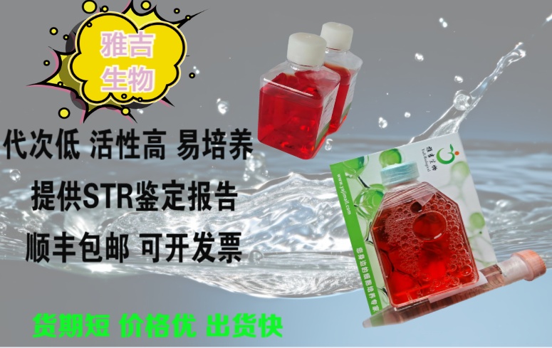 人卵巢癌细胞A2780/GFP