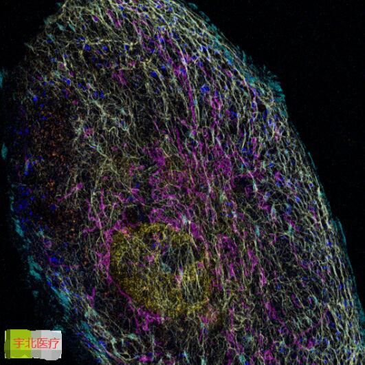 MASSIVE-SDAB-FAST X-PLEX 超分辨多重影像试剂盒