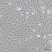 人前列腺癌细胞DU145(STR鉴定)