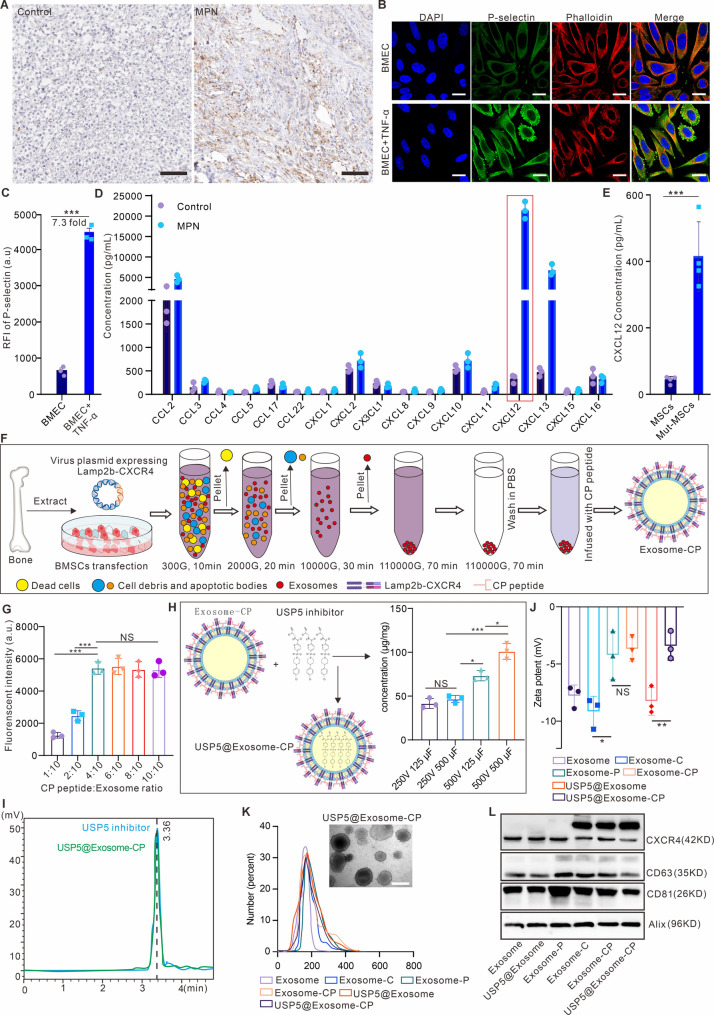 外泌体载药 外泌体载药