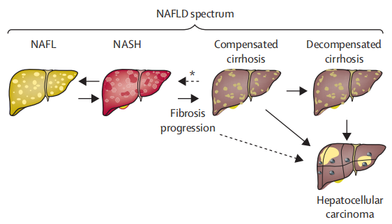 原代肝细胞-代谢功能障碍相关脂肪性肝炎(MASH)研究的核心模型