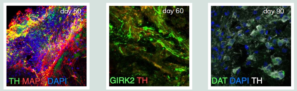 在Biosilk中培养的脑类器官DA神经元可分化成熟