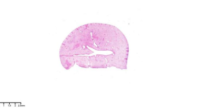 组织样本脱水不当染色不佳补救措施