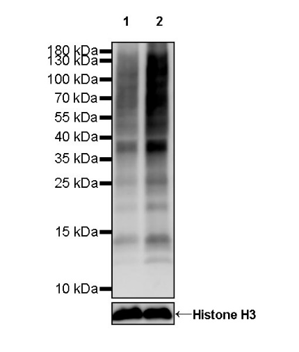 乳酸化的秘密：解锁代谢与疾病的新密码