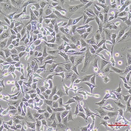 人非小细胞肺癌细胞 A549(STR鉴定)