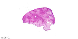 组织样本脱水不当染色不佳补救措施