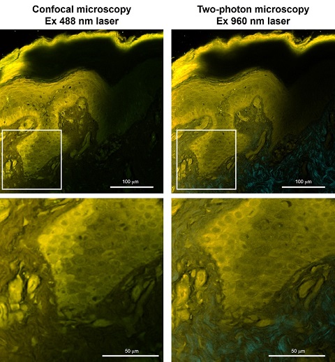 可实现局部组织结构可视化的荧光染料HistoBright