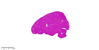 组织样本脱水不当染色不佳补救措施