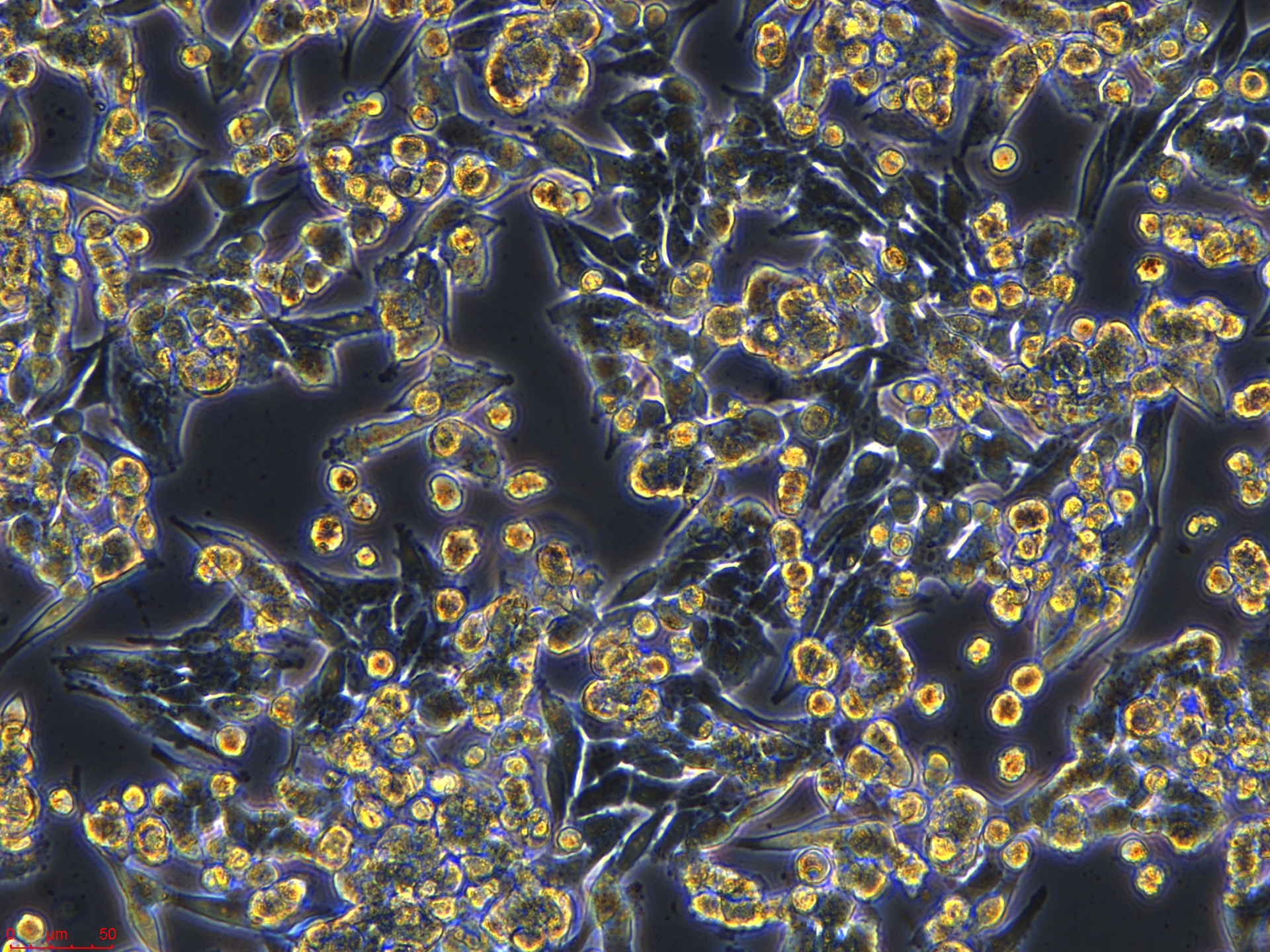 Project1_A-375    20X_ch00.jpg