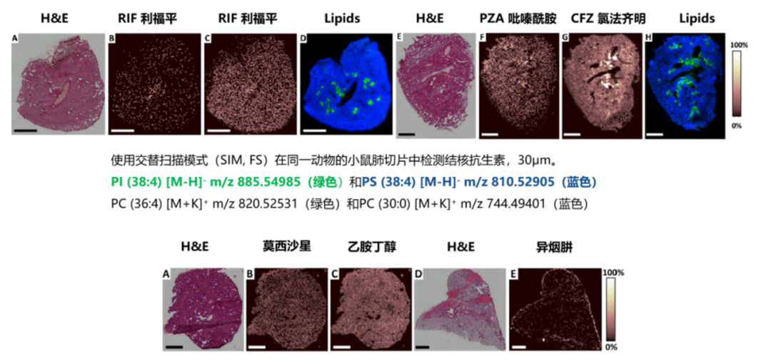 与典同行|质谱成像助力药物研究进入“空间组学”时代