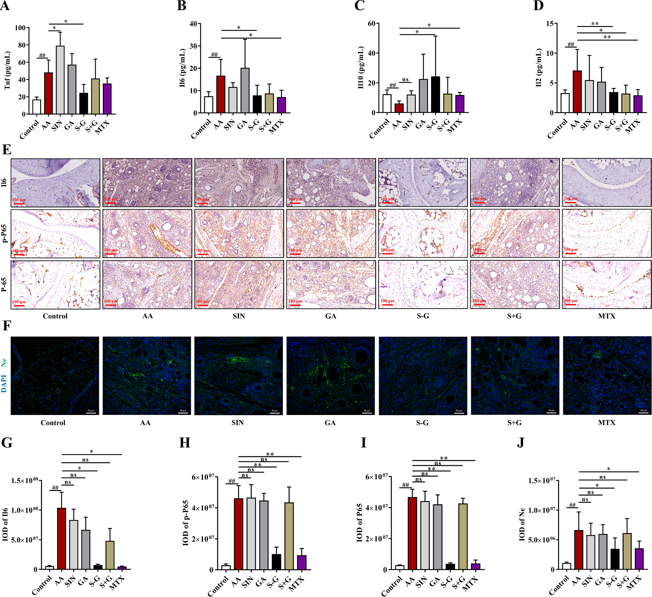 图5.S-G 水凝胶在体内抑制了 AA 小鼠的炎症反应