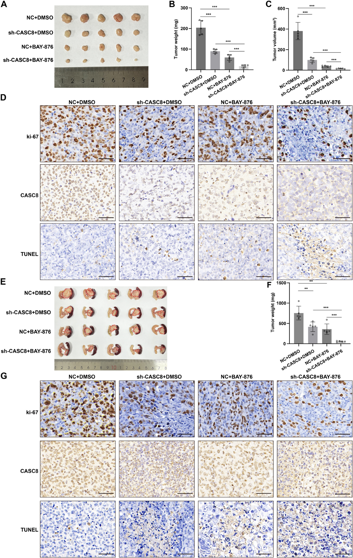 IF：12.8，高分捷径！单细胞×双硫死亡双热点碰撞，预后分析+多实验支撑，顶刊级发文模板！