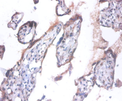 Epigentek-ANAPC5多克隆抗体大促销，科研好物低价购！